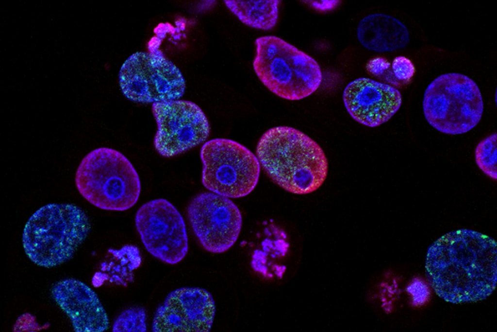 E. coli fluorescence sensor for water quality